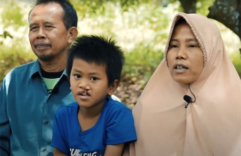 Anugrah and his parents before cleft surgery