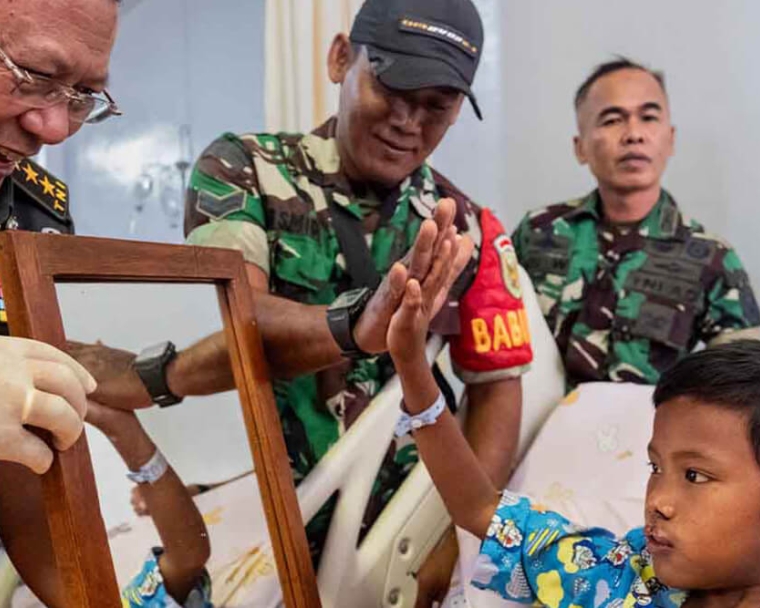 Tentara Indonesia tersenyum dan memberi semangat pada Rajib saat dia sedang berkaca setelah operasi bibir sumbingnya