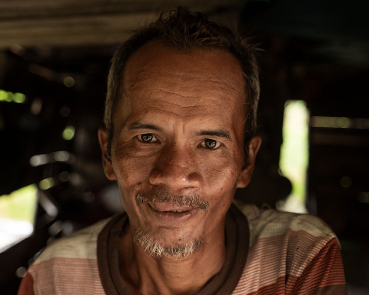 Alim smiling after cleft surgery